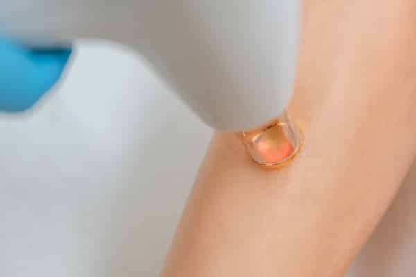 How To Get Rid Of Cellulite