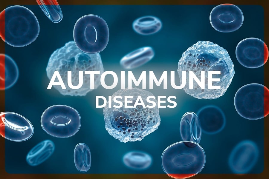 Autoimmune Diseases: Myths And Facts